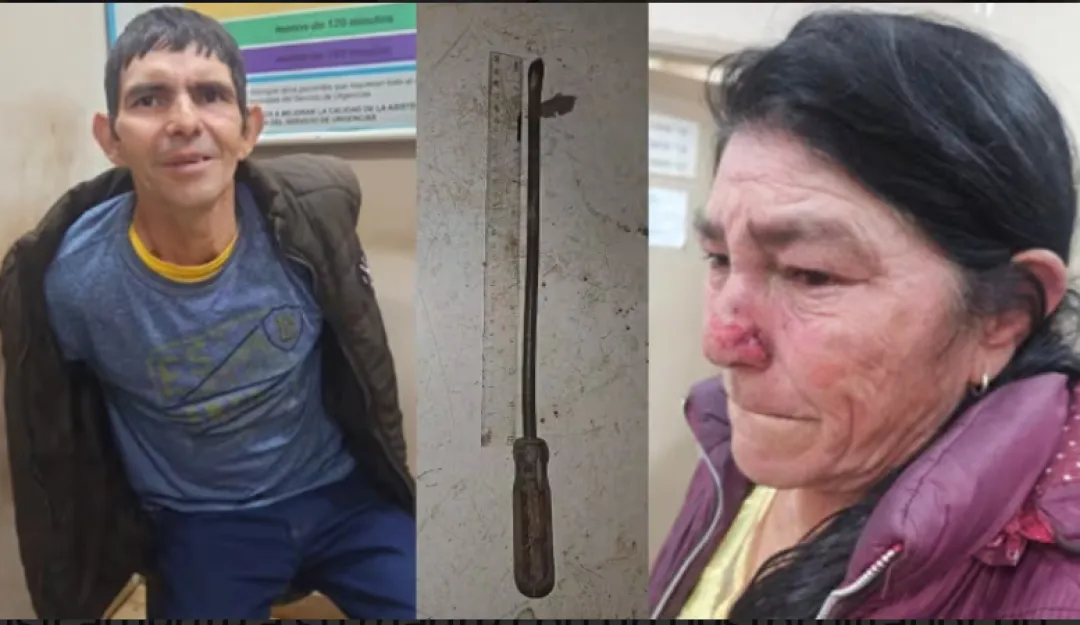 Imputan y piden prisión para hombre que atacó con un destornillador a su madre